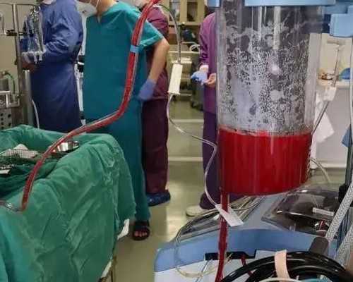 30岁卵巢衰退能恢复吗&供卵价格一般多少,2026武汉三代试管选男孩费用多少钱？