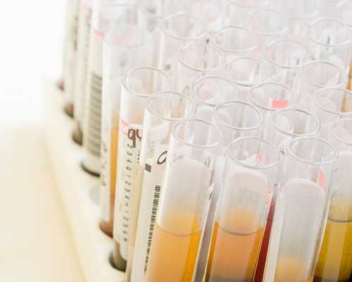 武汉供卵咨询代怀,武汉正规供卵试管医院,武汉正规供卵机构