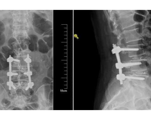做供卵多久会自己怀孕&代孕生男孩,备孕做到这3点更容易怀孕,快行动起来吧