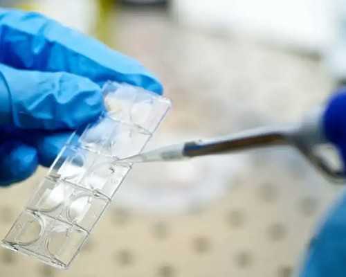 武汉代怀包成功公司,武汉同济医院做试管,武汉同济做试管多少钱