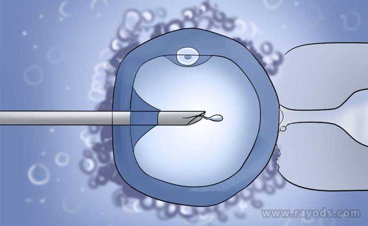 巢湖赠卵借卵试管_美国第三代试管婴儿流程是怎样的？